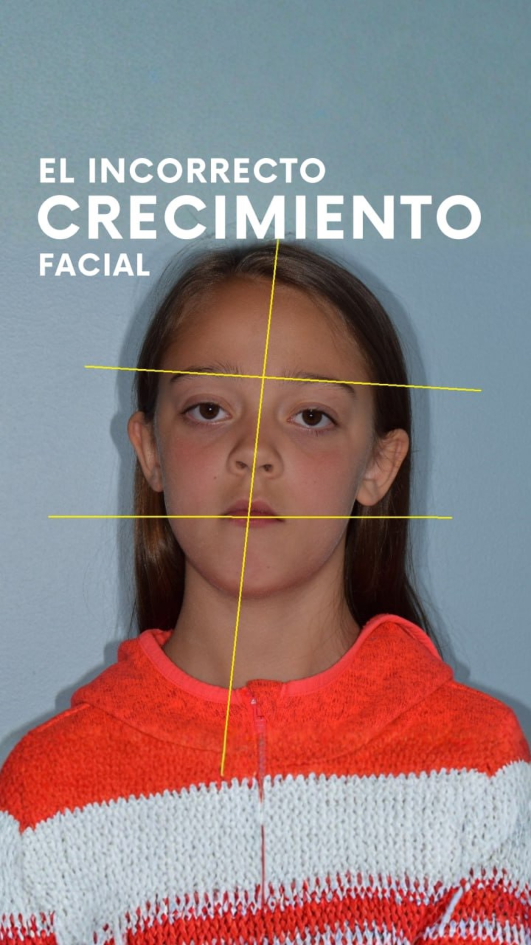 El crecimiento incorrecto